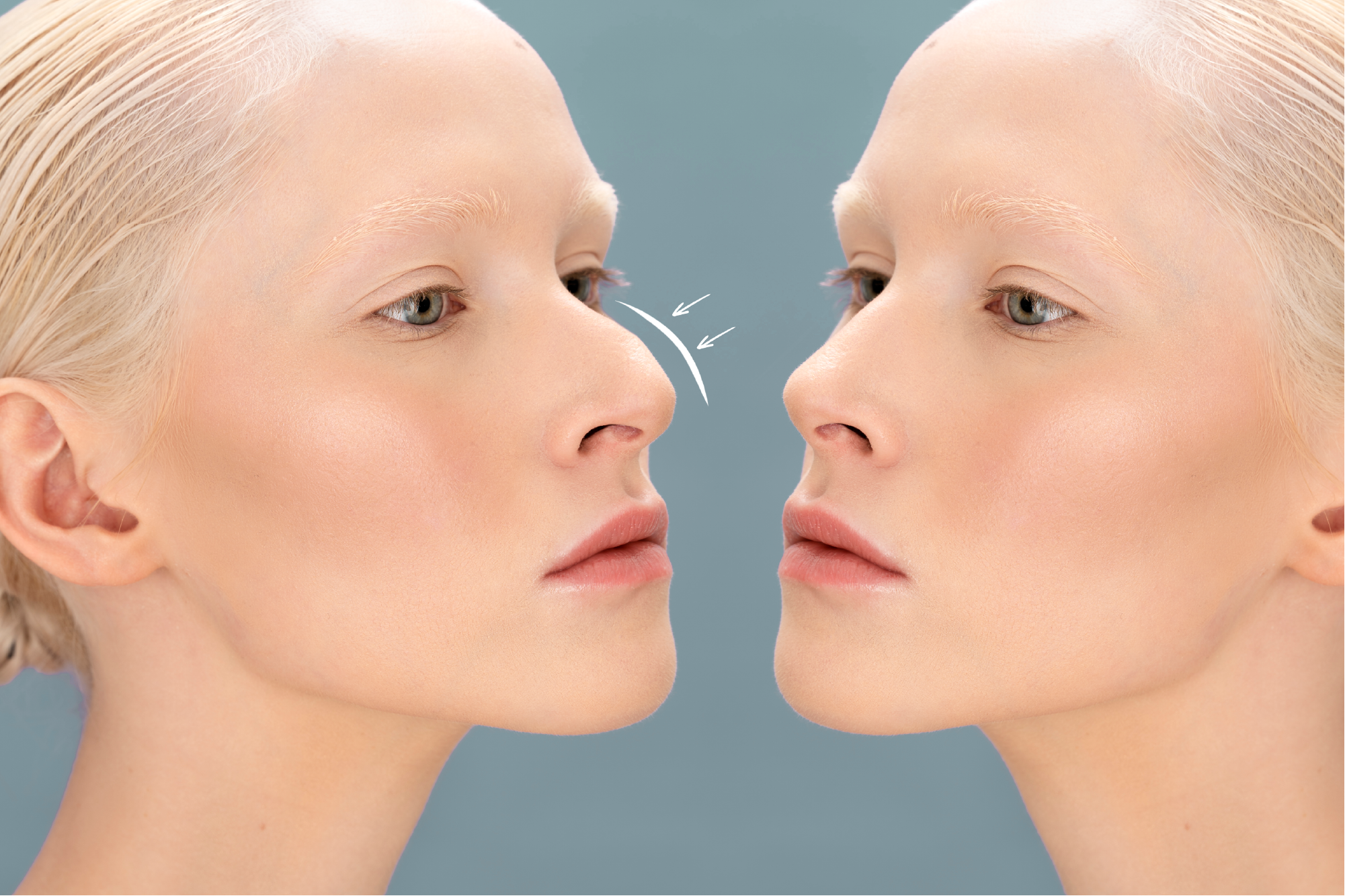 op.dr koray tumuklu gaziantep kbb uzmanı burun eğriliği