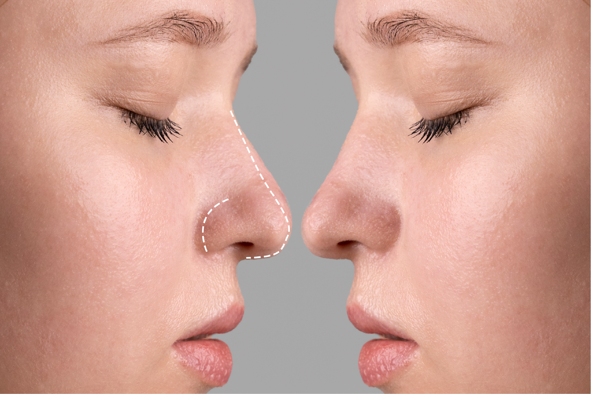 op.dr koray tumuklu gaziantep kbb uzmanı